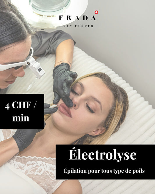 Électrolyse — Épilation Définitive 100%