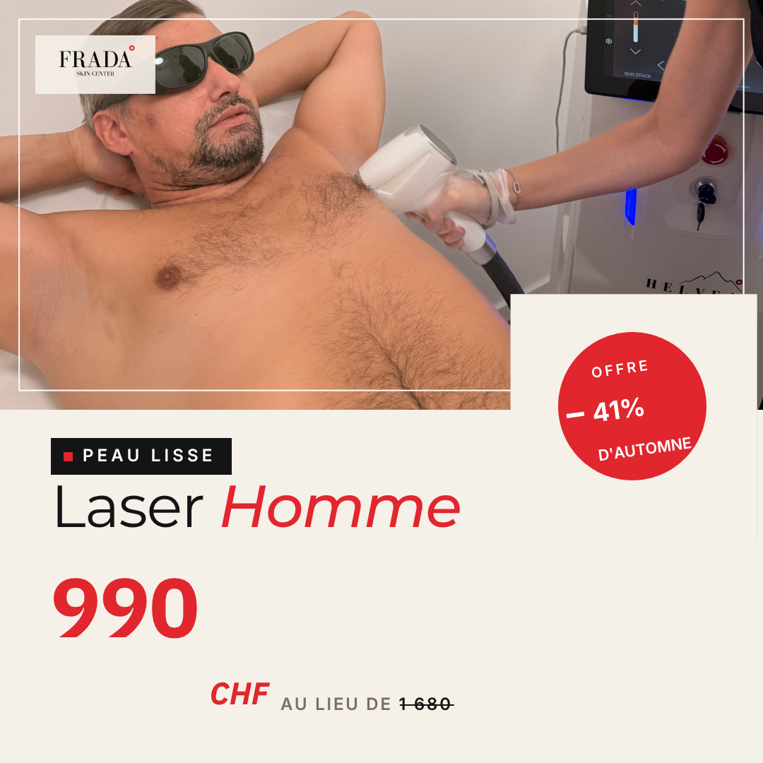Programme Laser Homme — 6 séances dos complet